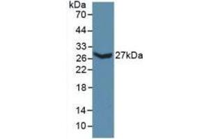 Detection of Recombinant COL3a1, Mouse using Polyclonal Antibody to Collagen Type III Alpha 1 (COL3a1) (COL3A1 抗体  (AA 434-643))