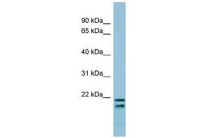 SFTPC antibody used at 1 ug/ml to detect target protein.