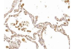 Detection of FLI1 in Human Lung Tissue using Polyclonal Antibody to Friend Leukemia Virus Integration 1 (FLI1) (FLI1 抗体  (AA 1-196))