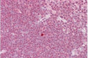 Immunohistochemistry with Thymus tissue at an antibody concentration of 5µg/ml using anti-ZBTB7A antibody (ARP39211_P050) (ZBTB7A 抗体  (N-Term))