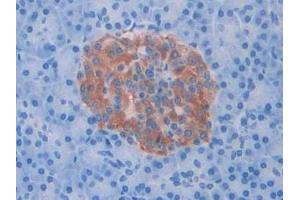 Detection of Slit1 in Human Pancreas Tissue using Polyclonal Antibody to Slit Homolog 1 (Slit1)
