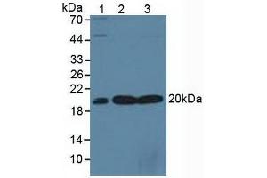 Figure. (SKP1 抗体  (AA 1-163))