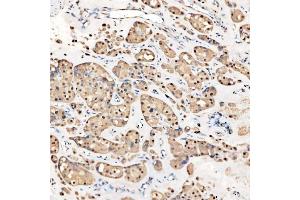 IHC analysis of SNRNP27 using anti-SNRNP27 antibody (ABIN7599614).