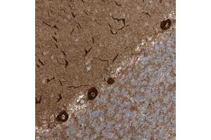 Immunohistochemical staining of human cerebellum with ECM2 polyclonal antibody  shows strong cytoplasmic and nucleolar positivity in purkinje cells at 1:200-1:500 dilution. (ECM2 抗体)