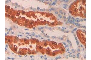 Detection of PAH in Human Kidney Tissue using Polyclonal Antibody to Phenylalanine Hydroxylase (PAH) (Phenylalanine Hydroxylase 抗体  (AA 1-226))