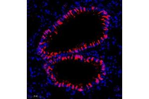 Immunofluorescence (Paraffin-embedded Sections) (IF (p)) image for anti-Cytochrome P450, Family 2, Subfamily S, Polypeptide 1 (CYP2S1) antibody (ABIN7073673)