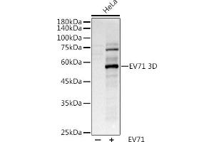 Western blot analysis of extracts of various cell lines, using (ABIN6127666, ABIN6140342, ABIN6140343 and ABIN6224720) at 1:1000 dilution. (EV71 抗体)