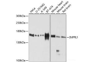 Western blot analysis of extracts of various cell lines using INPPL1 Polyclonal Antibody at dilution of 1:1000. (INPPL1 抗体)