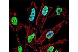 Fluorescent confocal image of HeLa cell stained with NKX1. (NKX1-1 抗体  (AA 1-1))
