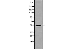 anti-Guanine Nucleotide Binding Protein (G Protein), beta Polypeptide 3 (GNB3) (C-Term) antibody