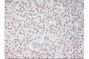 Immunohistochemistry (IHC) image for anti-Vascular Endothelial Growth Factor A (VEGFA) (AA 27-233) antibody (ABIN1491302)