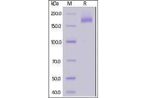 SARS S protein (R667A, K968P, V969P), His Tag on  under reducing (R) condition. (SARS-CoV Spike Protein (AA 14-1195) (His tag))