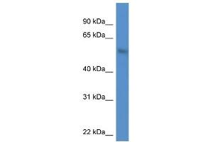 WB Suggested Anti-MKNK1 AntibodyTitration: 1. (MKNK1 抗体  (N-Term))