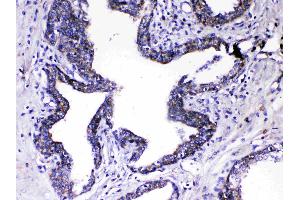 Immunohistochemistry (IHC) image for anti-Relaxin 1 (RLN1) antibody (ABIN5519057)