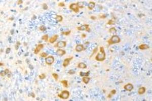 Immunohistochemistry analysis of paraffin-embedded mouse cerebellum using p39 (ABIN7074968) at dilution of 1: 1500 (p39 抗体)