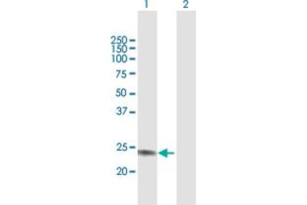 GALNT9 antibody  (AA 1-237)