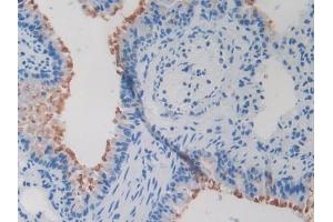 IHC-P analysis of Mouse Lung Tissue, with DAB staining.