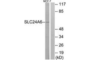 Western blot analysis of extracts from MCF-7 cells, using SLC24A6 Antibody. (SLC24A6 抗体  (AA 494-543))