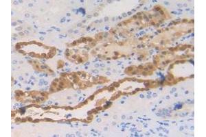 Detection of S100A2 in Human Kidney Tissue using Polyclonal Antibody to S100 Calcium Binding Protein A2 (S100A2) (S100A2 抗体  (AA 2-98))