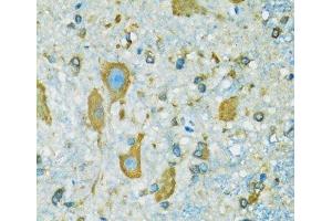 Immunohistochemistry (Paraffin-embedded Sections) (IHC (p)) image for anti-Ribosomal Protein S7 (RPS7) antibody (ABIN7262639)