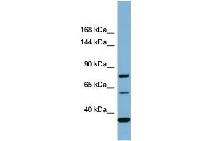 Host:  Rabbit  Target Name:  MYO16  Sample Type:  COLO205 Whole cell lysates  Antibody Dilution:  1. (Myosin XVI 抗体  (Middle Region))