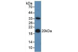 Detection of ADM in Mouse Liver Tissue using Polyclonal Antibody to Adrenomedullin (ADM) (Adrenomedullin 抗体  (AA 24-171))