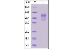 Human Syndecan-1, His Tag on  under reducing (R) condition. (Syndecan 1 Protein (SDC1) (AA 23-254) (His tag))