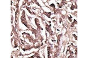 Immunohistochemistry (IHC) image for anti-ATG7 Autophagy Related 7 (ATG7) (AA 284-313) antibody (ABIN3029987)