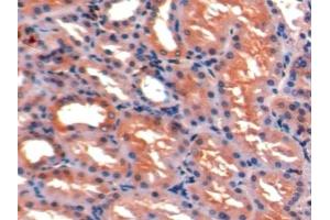 Detection of ICAM1 in Porcine Kidney Tissue using Polyclonal Antibody to Intercellular Adhesion Molecule 1 (ICAM1) (ICAM1 抗体  (AA 27-209))
