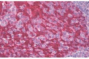 Image no. 1 for anti-Stratifin (SFN) (AA 120-170) antibody (ABIN1490876) (14-3-3 sigma/SFN 抗体  (AA 120-170))