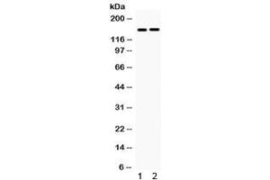 Western blot testing of 1) rat skeletal muscle and 2) human COLO320 lysate with HDAC6 antibody.