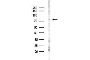 anti-Adrenergic, Beta, Receptor Kinase 1 (ADRBK1) (Internal Region) antibody