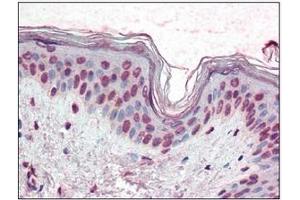 Immunohistochemistry (IHC) image for anti-X-Box Binding Protein 1 (XBP1) (AA 2-160) antibody (ABIN492538) (XBP1 抗体  (AA 2-160))