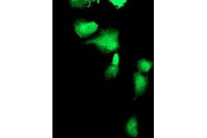 Anti-FBXO21 mouse monoclonal antibody (ABIN2455368) immunofluorescent staining of COS7 cells transiently transfected by pCMV6-ENTRY FBXO21 (RC223095). (FBXO21 抗体)