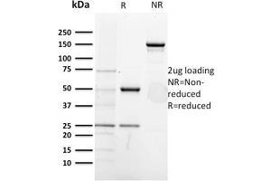 SDS-PAGE AnalysisPurified CD5-Monospecific Mouse Monoclonal Antibody (CD5/2418). (CD5 抗体  (AA 269-366))