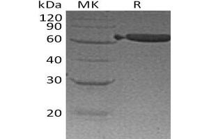 Western Blotting (WB) image for Epithelial Cell Adhesion Molecule (EPCAM) (Active) protein (Fc Tag) (ABIN7320835)