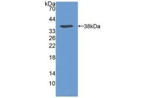 Detection of Recombinant VLDLR, Human using Polyclonal Antibody to Very Low Density Lipoprotein Receptor (VLDLR) (VLDLR 抗体  (AA 418-722))