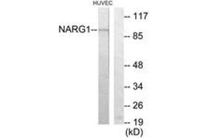 Western blot analysis of extracts from HuvEc cells, using NARG1 Antibody. (NAA15 抗体  (AA 221-270))