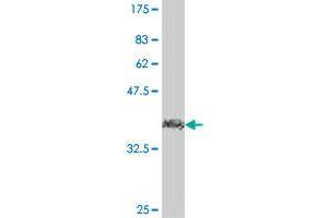 Western Blot detection against Immunogen (38. (FBXL17 抗体  (AA 194-303))