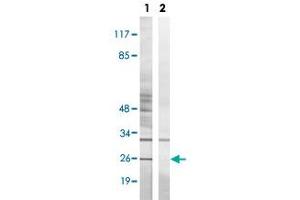 Western blot analysis of Lane 1: Untreated K562 cell lysates, Lane 2: Synthesized peptide treated K562 cell lysates reacted with BIK (phospho T33) polyclonal antibody  at 1:500-1:3000 dilution. (BIK 抗体  (pThr33))