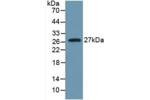 Detection of Recombinant IL6, Rat using Monoclonal Antibody to Interleukin 6 (IL6) (IL-6 抗体  (AA 25-211))