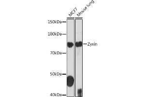 Western blot analysis of extracts of various cell lines, using Zyxin Rabbit mAb (ABIN1682627, ABIN3015962, ABIN3015963 and ABIN7101467) at 1:1000 dilution. (ZYX 抗体)