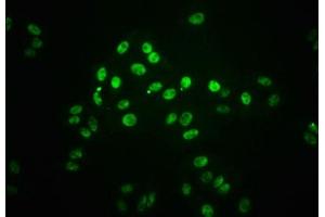 Immunofluorescence staining of HepG2 cells(treated with 100 mM Calyculin A for 30 min) with ABIN7127753 at 1:66,counter-stained with DAPI. (Recombinant STAT1 抗体  (pSer727))