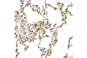 Immunohistochemistry of paraffin-embedded rat lung using Cullin 1 Rabbit pAb (ABIN3015863, ABIN3015864, ABIN3015865 and ABIN6219345) at dilution of 1:50 (40x lens). (Cullin 1 抗体  (AA 500-776))