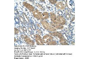 Rabbit Anti-SLC1A5 Antibody  Paraffin Embedded Tissue: Human Kidney Cellular Data: Epithelial cells of renal tubule Antibody Concentration: 4. (SLC1A5 抗体  (Middle Region))