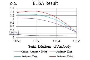 Black line: Control Antigen (100 ng), Purple line: Antigen(10 ng), Blue line: Antigen (50 ng), Red line: Antigen (100 ng), (SOX9 抗体)