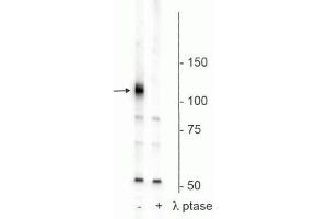 Western blot of rat hippocampal membrane lysate showing specific immunolabeling of the ~120 kDa Polo-Like Kinase Kinase phosphorylated at Ser482,486,490 in the first lane (-). (PLK1 抗体  (pSer482, pSer486, pSer490))