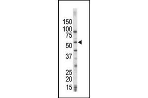 Image no. 1 for anti-Mitogen-Activated Protein Kinase Kinase Kinase 8 (MAP3K8) (C-Term) antibody (ABIN360360) (MAP3K8 抗体  (C-Term))