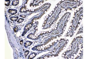 IHC analysis of Caspase8 using anti-Caspase8 antibody . (Caspase 8 抗体  (N-Term))