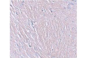 Immunohistochemistry of SYNPO in human brain tissue with SYNPO Antibody  at 2. (SYNPO 抗体  (C-Term))